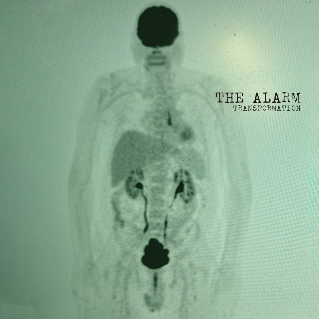 Alarm - Transformation - Lp