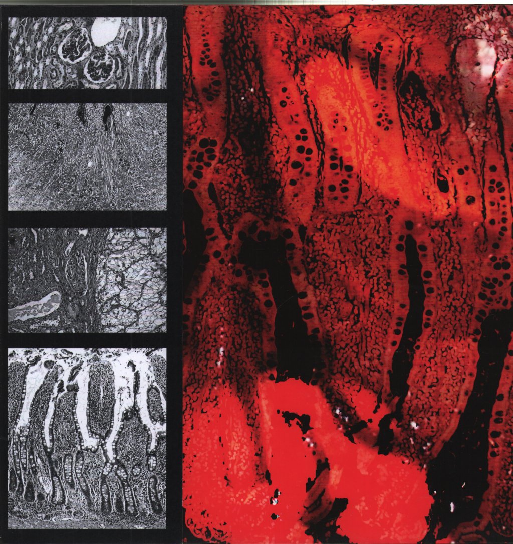 Medicine Noose/Spewn - Split LP - Lp