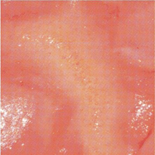 Klamp - Hate You - Lp